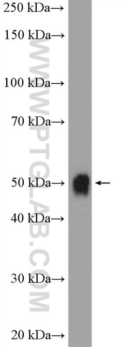 UGT2B7 Rabbit anti-Human, Mouse, Polyclonal, Proteintech:Antibodies:Primary