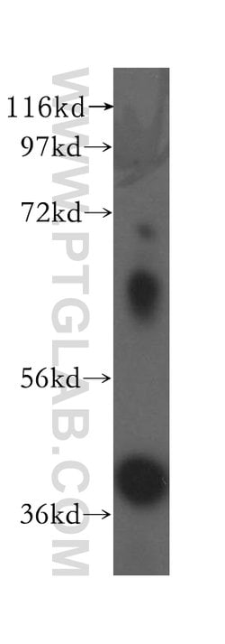 Haptoglobin Rabbit anti-Human, Mouse, Rat, Polyclonal, Proteintech 150