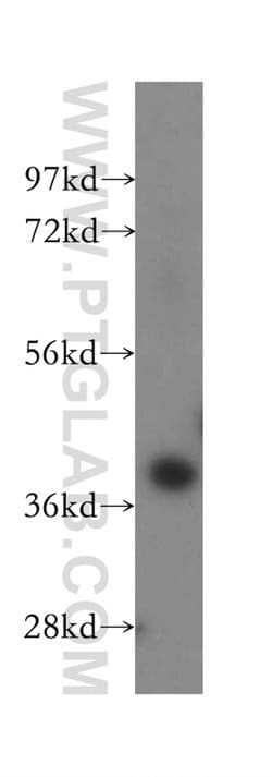 Haptoglobin Rabbit anti-Human, Mouse, Rat, Polyclonal, Proteintech 150