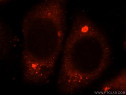 GTDC1 Rabbit anti-Human, Mouse, Rat, Polyclonal, Proteintech 150 &mu;L;