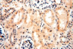 GTDC1 Rabbit anti-Human, Mouse, Rat, Polyclonal, Proteintech 150 &mu;L;