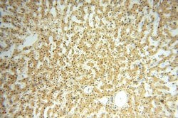 GTDC1 Rabbit anti-Human, Mouse, Rat, Polyclonal, Proteintech 150 &mu;L;