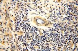 GTDC1 Rabbit anti-Human, Mouse, Rat, Polyclonal, Proteintech