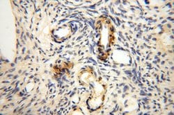 GTDC1 Rabbit anti-Human, Mouse, Rat, Polyclonal, Proteintech 150 &mu;L;