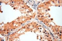 GTDC1 Rabbit anti-Human, Mouse, Rat, Polyclonal, Proteintech 150 &mu;L;