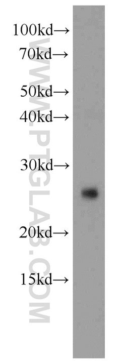 CD3 delta Rabbit anti-Human, Mouse, Polyclonal, Proteintech 150 &mu;L;