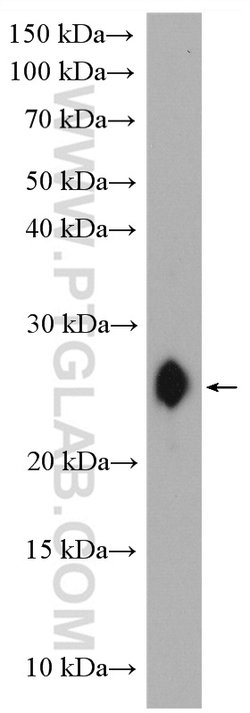 CD3 delta Rabbit anti-Human, Mouse, Polyclonal, Proteintech 150 &mu;L;