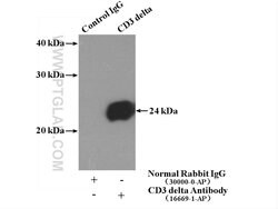 CD3 delta Rabbit anti-Human, Mouse, Polyclonal, Proteintech 150 &mu;L;