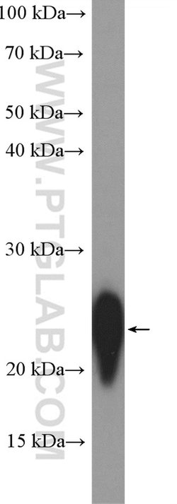 CD3 delta Rabbit anti-Human, Mouse, Polyclonal, Proteintech 150 &mu;L;