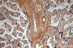 HPSE Rabbit anti-Human, Mouse, Rat, Polyclonal, Proteintech:Antibodies:Primary
