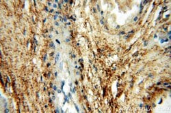 HPSE Rabbit anti-Human, Mouse, Rat, Polyclonal, Proteintech:Antibodies:Primary