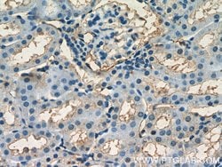 HPSE Rabbit anti-Human, Mouse, Rat, Polyclonal, Proteintech:Antibodies:Primary