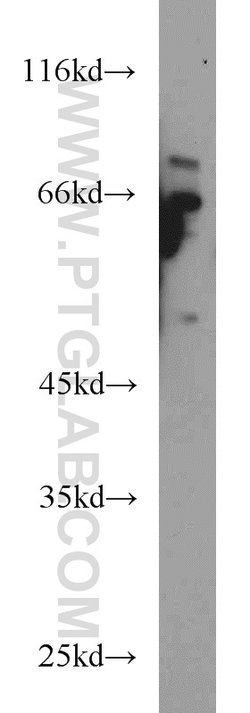 HPSE Rabbit anti-Human, Mouse, Rat, Polyclonal, Proteintech:Antibodies:Primary