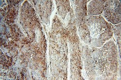 HPSE Rabbit anti-Human, Mouse, Rat, Polyclonal, Proteintech:Antibodies:Primary