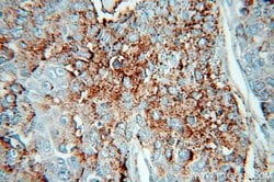 HPSE Rabbit anti-Human, Mouse, Rat, Polyclonal, Proteintech:Antibodies:Primary
