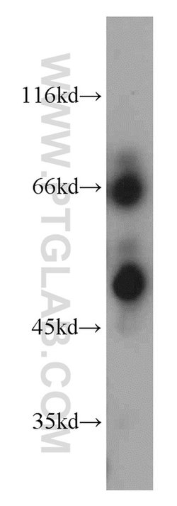 HPSE Rabbit anti-Human, Mouse, Rat, Polyclonal, Proteintech:Antibodies:Primary