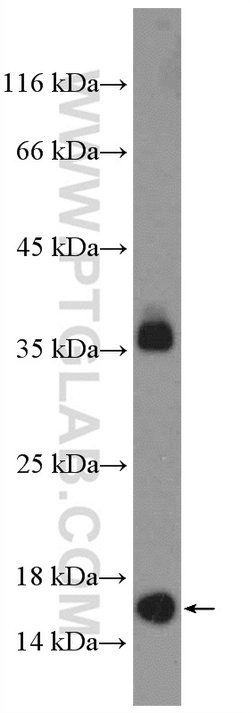 POLR1D Rabbit anti-Human, Mouse, Rat, Polyclonal, Proteintech:Antibodies:Primary