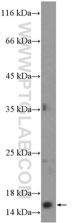POLR1D Rabbit anti-Human, Mouse, Rat, Polyclonal, Proteintech:Antibodies:Primary