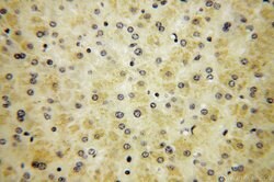 RPS14 Rabbit anti-Human, Mouse, Rat, Polyclonal, Proteintech 150 &mu;L;