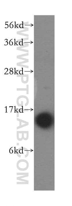 RPS14 Rabbit anti-Human, Mouse, Rat, Polyclonal, Proteintech:  