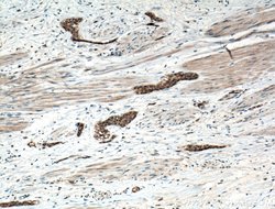 CRK Rabbit anti-Human, Mouse, Polyclonal, Proteintech 150 &mu;L; Unconjugated:Antibodies,