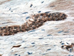 CRK Rabbit anti-Human, Mouse, Polyclonal, Proteintech 150 &mu;L; Unconjugated:Antibodies,