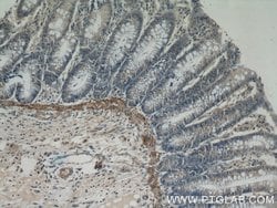 PARP11 Rabbit anti-Human, Mouse, Rat, Polyclonal, Proteintech 20 &mu;L;