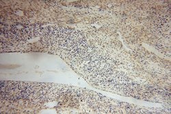 Proteintech PARP11 Rabbit anti-Human, Mouse, Rat, Polyclonal, Proteintech