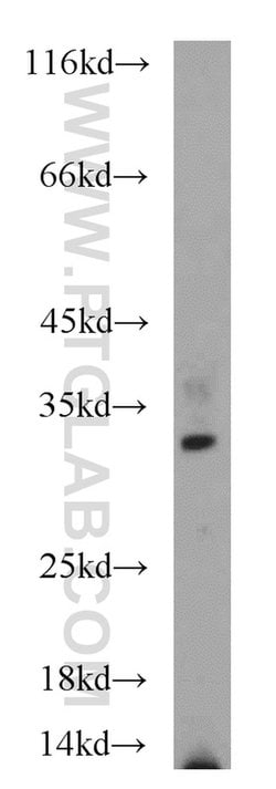 PARP11 Rabbit anti-Human, Mouse, Rat, Polyclonal, Proteintech 20 &mu;L;