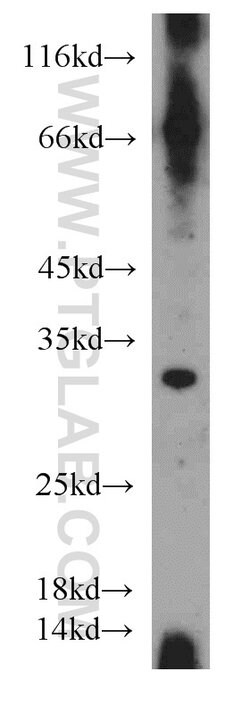 PARP11 Rabbit anti-Human, Mouse, Rat, Polyclonal, Proteintech 20 &mu;L;