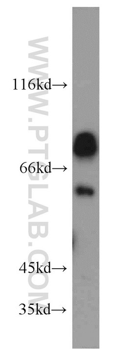 NKD2 Rabbit anti-Human, Mouse, Rat, Polyclonal, Proteintech 150 &mu;L;