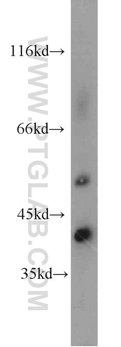 NKD2 Rabbit anti-Human, Mouse, Rat, Polyclonal, Proteintech