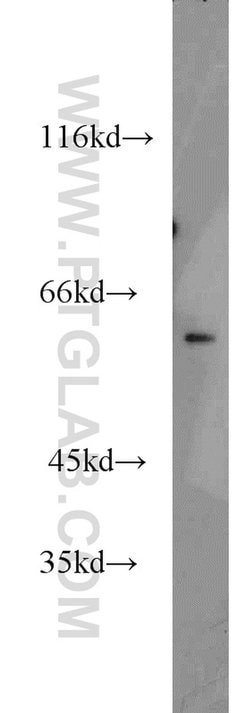 NKD2 Rabbit anti-Human, Mouse, Rat, Polyclonal, Proteintech 150 &mu;L;