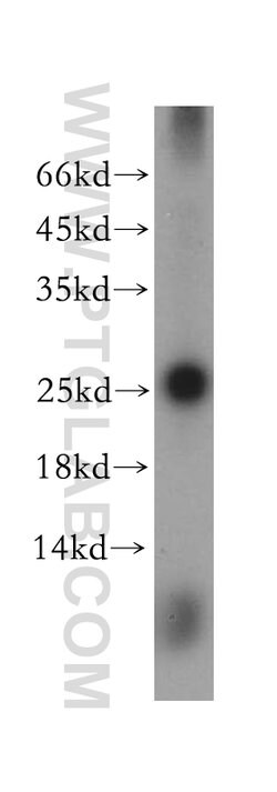 GSTA3 Rabbit anti-Human, Mouse, Rat, Polyclonal, Proteintech 150 &mu;L;