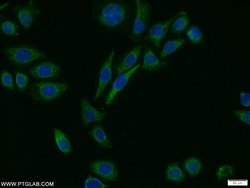 MTH1 Rabbit anti-Human, Mouse, Rat, Polyclonal, Proteintech 150 &mu;L;