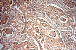 MTH1 Rabbit anti-Human, Mouse, Rat, Polyclonal, Proteintech 150 &mu;L;