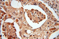 MTH1 Rabbit anti-Human, Mouse, Rat, Polyclonal, Proteintech 150 &mu;L;