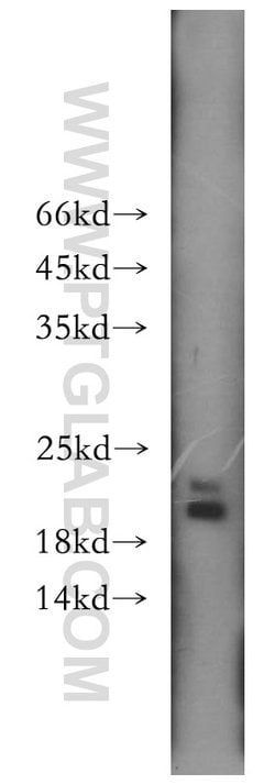MTH1 Rabbit anti-Human, Mouse, Rat, Polyclonal, Proteintech 150 &mu;L;