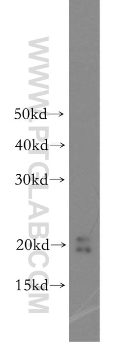 MTH1 Rabbit anti-Human, Mouse, Rat, Polyclonal, Proteintech