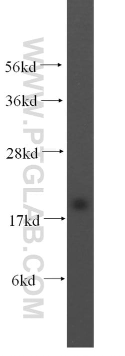 MTH1 Rabbit anti-Human, Mouse, Rat, Polyclonal, Proteintech 150 &mu;L;