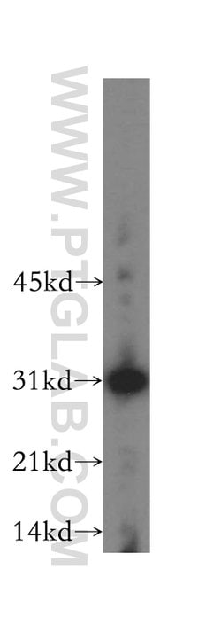 RPL7L1 Rabbit anti-Human, Mouse, Rat, Polyclonal, Proteintech 20 &mu;L;