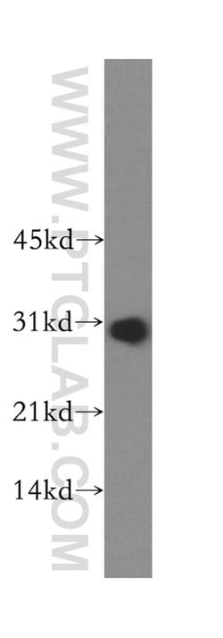 RPL7L1 Rabbit anti-Human, Mouse, Rat, Polyclonal, Proteintech 20 &mu;L;
