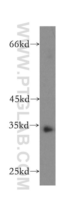 NPL Rabbit anti-Human, Mouse, Rat, Polyclonal, Proteintech:Antibodies:Primary