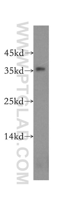 NPL Rabbit anti-Human, Mouse, Rat, Polyclonal, Proteintech:Antibodies:Primary