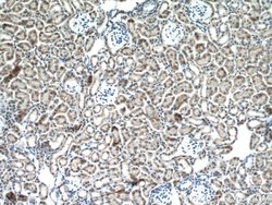 GALNT3 Rabbit anti-Human, Mouse, Rat, Polyclonal, Proteintech:Antibodies:Primary