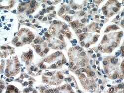 GALNT3 Rabbit anti-Human, Mouse, Rat, Polyclonal, Proteintech:Antibodies:Primary