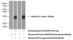 GALNT3 Rabbit anti-Human, Mouse, Rat, Polyclonal, Proteintech:Antibodies:Primary