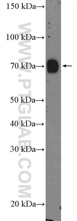 GALNT3 Rabbit anti-Human, Mouse, Rat, Polyclonal, Proteintech:Antibodies:Primary