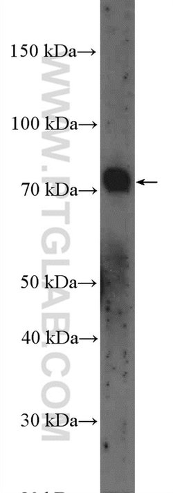GALNT3 Rabbit anti-Human, Mouse, Rat, Polyclonal, Proteintech:Antibodies:Primary
