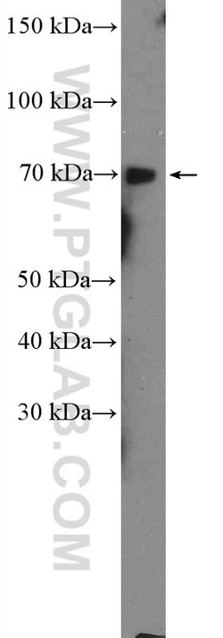GALNT3 Rabbit anti-Human, Mouse, Rat, Polyclonal, Proteintech:Antibodies:Primary